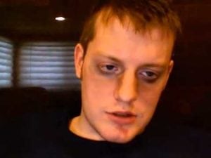 methadone withdrawal symptoms