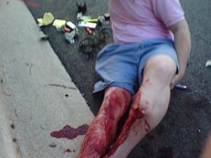 tramadol for opiate withdrawal