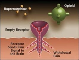 is suboxone an opioid