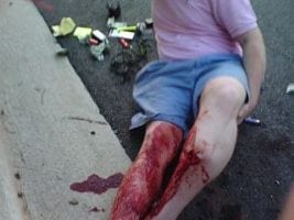 ultram for opiate withdrawal symptoms