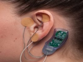 nss-2 bridge device for opiate withdrawal review