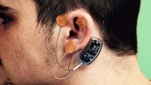 nss-2 bridge device for opiate withdrawal review