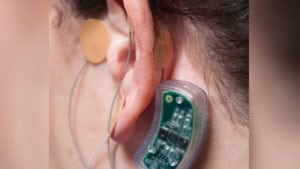 nss-2 bridge device review