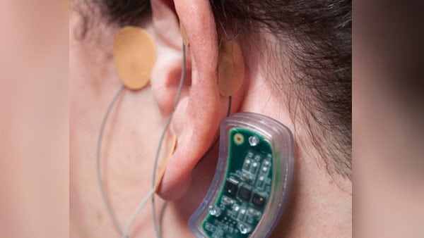 nss-2 bridge device review