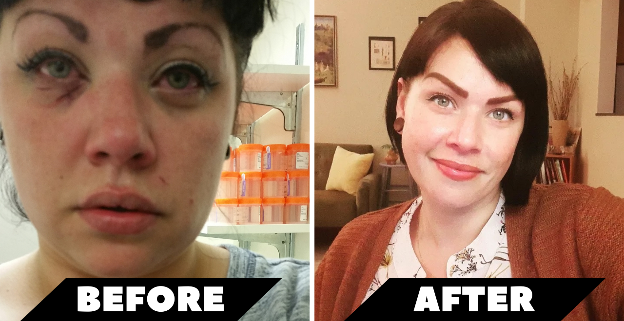 addiction recovery and near death experience nde overdose