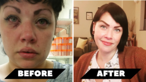 addiction recovery and near death experience nde overdose